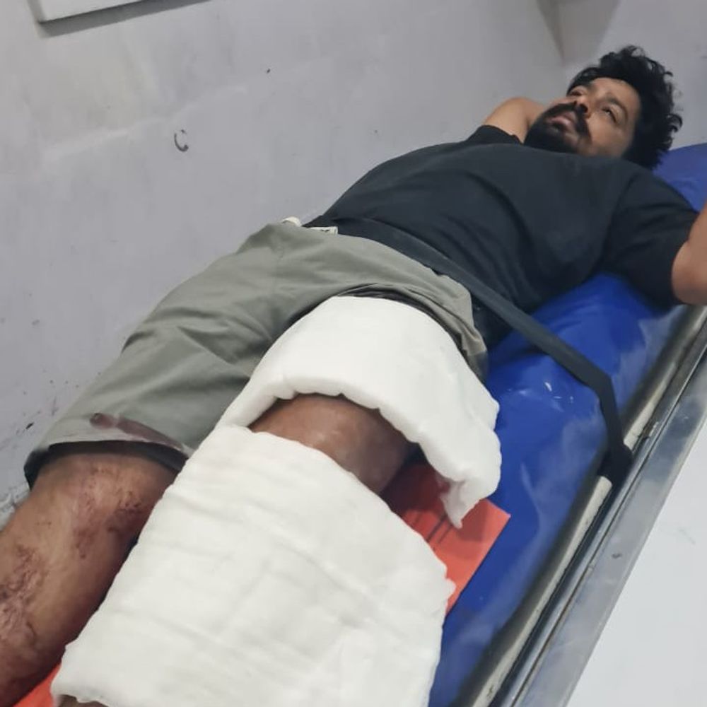 तरनतारन में कहासुनी के बाद युवक को गोली मारी:सरेबाजार दो अज्ञात बाइकसवारों ने की वारदात, घर का सामान खरीदने गया था