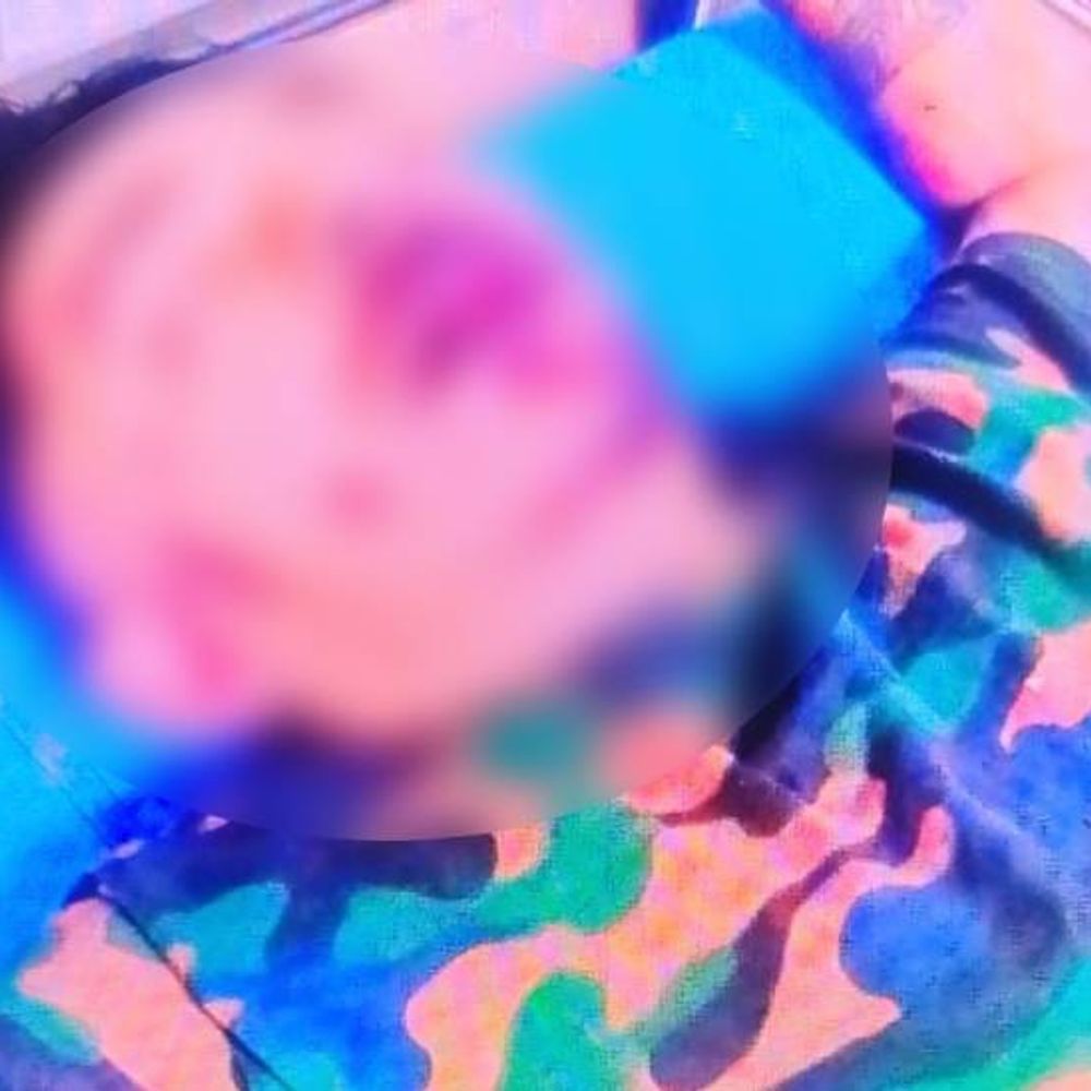 पानीपत में ट्रक ड्राइवर पर नुकीले हथियार से हमला:डयूटी से लौटते वक्त बाइक सवारों ने घेरा; होंठ पर वार