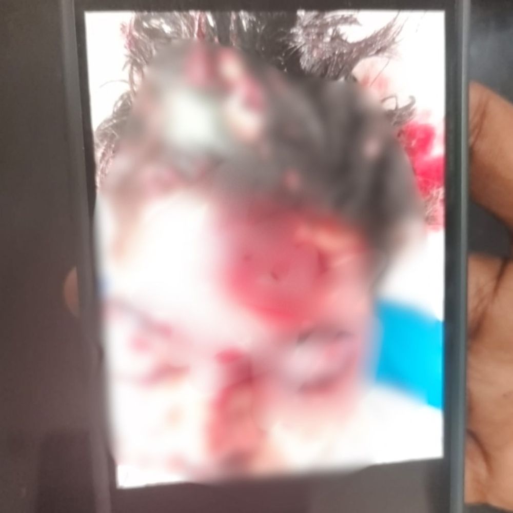 फरीदाबाद में दोस्त से चली गोली, डिलीवरी बॉय की मौत:गेहूं के कट्टे में मिली देसी पिस्टल, देखते समय हादसा, आरोपी के भाई ने खरीदी थी