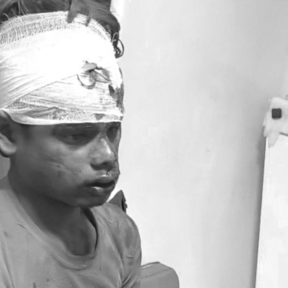 पंचकूला में शिमला हाईवे पर पलटी स्कूटी:अचानक बिगड़ा संतुलन, 4 युवक घायल, तीन की हालत नाजुक, हायर सेंटर रेफर