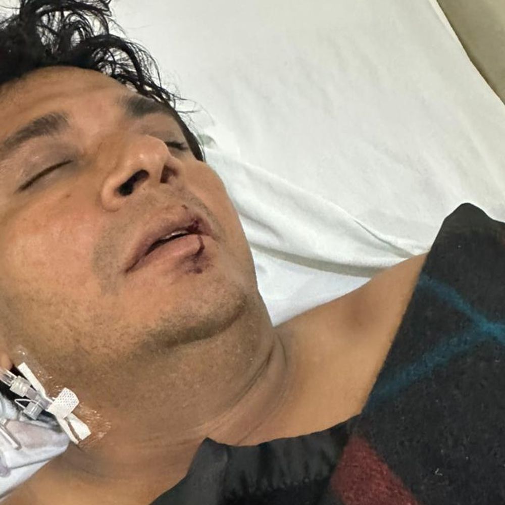 बल्लभगढ़ की मंडी में आढ़ती पर हमला:10-12 युवकों ने लाठी-डंडों और रॉड से किए वार; परिजनों ने पुलिसकर्मी पर लगाए आरोप