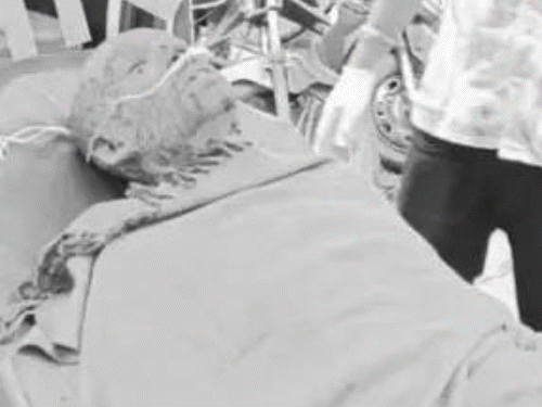 रामगढ़ में इस्पात प्लांट का फर्नेस फटा:धमाके से मचा हड़कंप, 9 मजदूर गंभीर रूप से झुलसे, अफरा-तफरी के बीच रांची रेफर