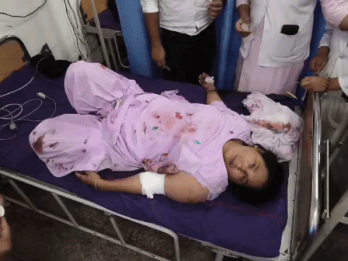 यमुनानगर में कार की टक्कर से ऑटो पलटा:सात महिलाओं सहित 10 घायल, रस्म क्रिया में शामिल होने अंबाला जा रहे थे