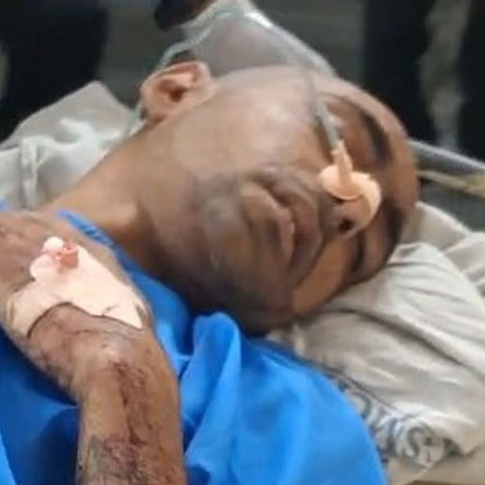 फरीदकोट केंद्रीय जेल में कैदियों के दो गुटों में झड़प:ईंटों और पाइपों से एक-दूसरे पर हमला, 4 लोग घायल; अस्पताल में इलाज जारी