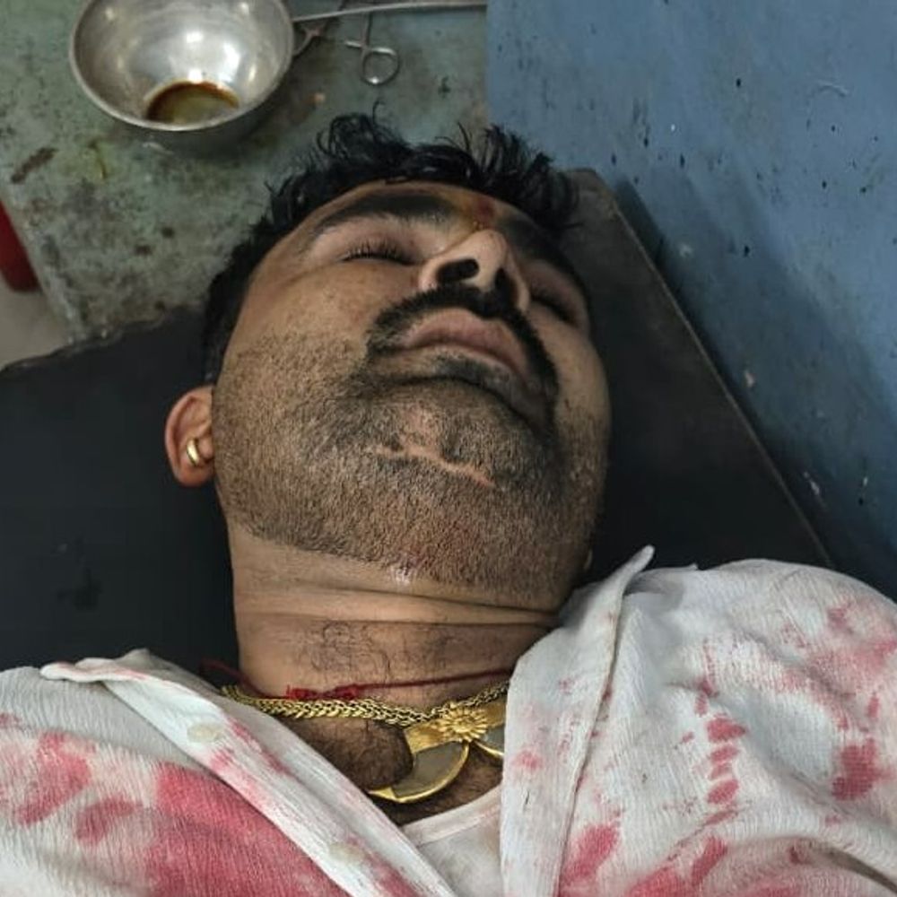 खुद की 12 बोर बंदूक गिरने से हुआ था फायर:सागर में गोलीकांड का खुलासा; युवक ने रची थी अज्ञात बाइक सवारों के हमले की झूठी कहानी