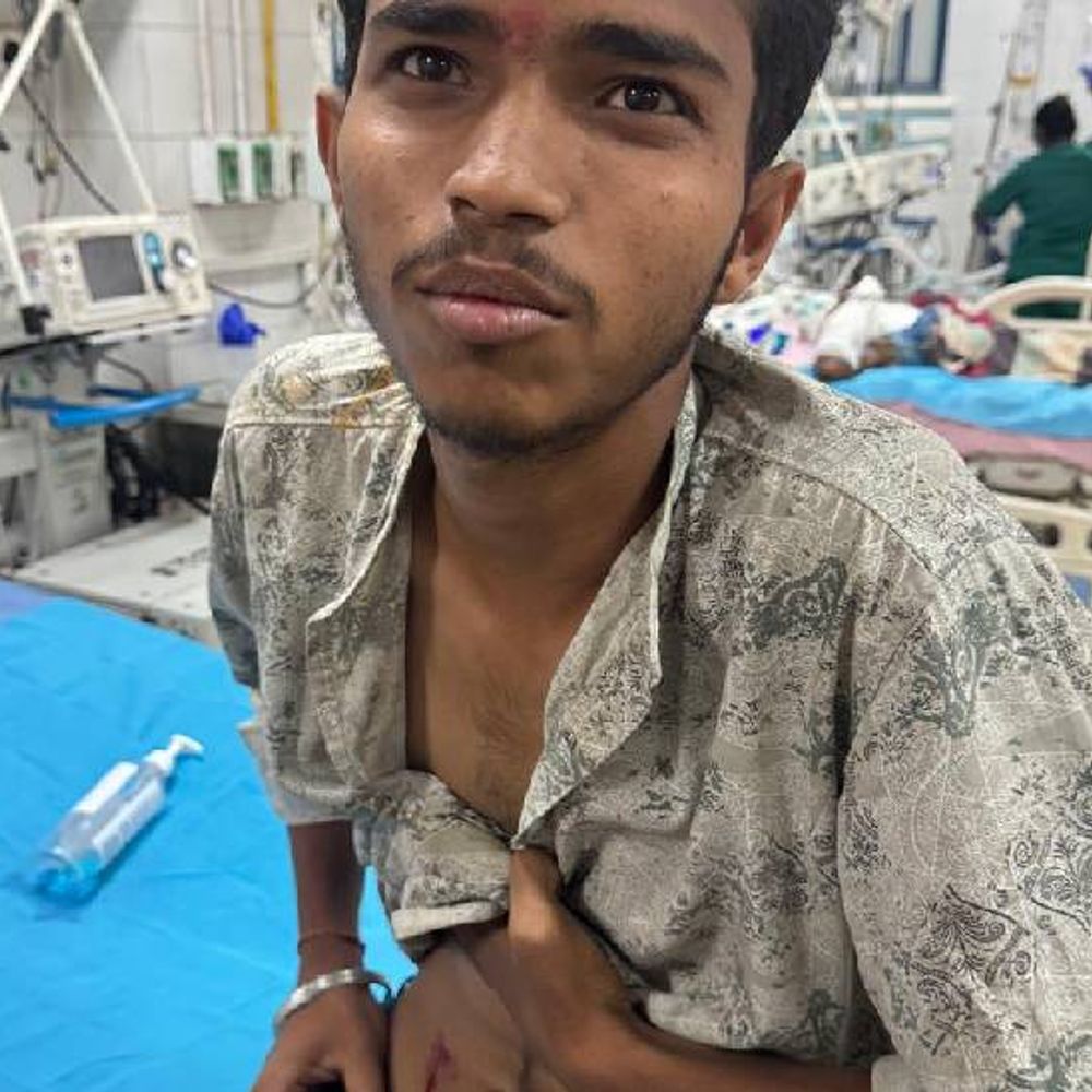 भोपाल में बीबीए और बीटेक के स्टूडेंट्स को मारी गोली:कटारा हिल्स में शराब पार्टी कर रहे छात्रों ने की फायरिंग; धमकी देकर आरोपी हुए फरार