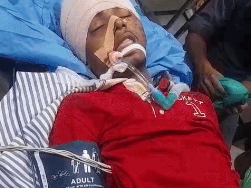 तरनतारन में युवक पर हमला, सिर में लगी गोली:काम से कहीं जा रहा था, रास्ते में अज्ञात बदमाशों ने की फायरिंग, हालत नाजुक