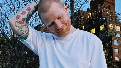 Shingles Treatment: Ed Sheeran reveals shingles diagnosis: What it is and why you should care