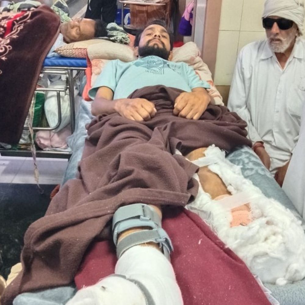 कैथल में ट्रैक्टर ने युवक को कुचला:फसल बेचने साइलो ढांड गया था; इलाज के दौरान काटनी पड़ी टांग