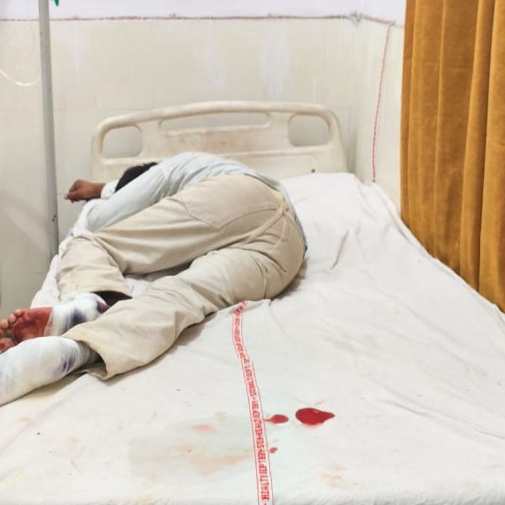 चेयरमैन के घर फायरिंग करने वाले बदमाश का एनकाउंटर:कुरुक्षेत्र में पर्ची फेंककर चलाई थीं गोलियां; सिपाही की बुलेटप्रूफ जैकेट पर लगी गोली