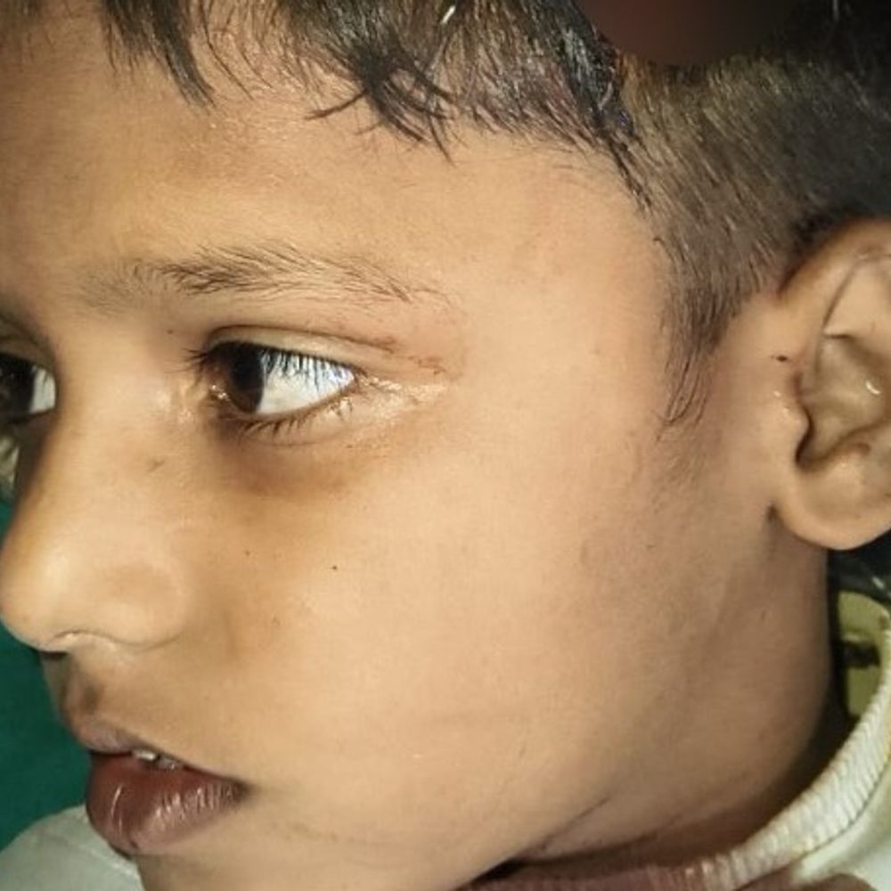 पटियाला में घर में घुसकर परिवार पर हमला:बच्चे समेत तीन लोग घायल, पुरानी रंजिश में दिया वारदात को अंजाम