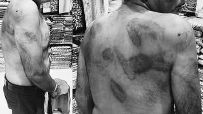 ‘They beat me as if I was a terrorist’: Delhi man claims hours of torture inside police station | Delhi News