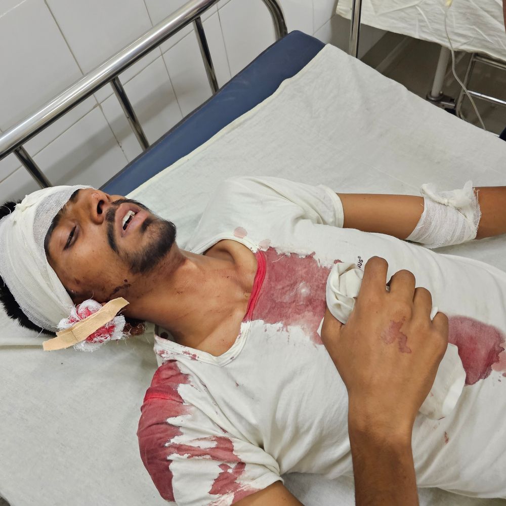 अबोहर रेलवे स्टेशन पर छात्रों के दो गुट भिड़े:ईंट लगने से युवक गंभीर घायल; फरीदकोट मेडिकल कॉलेज रेफर