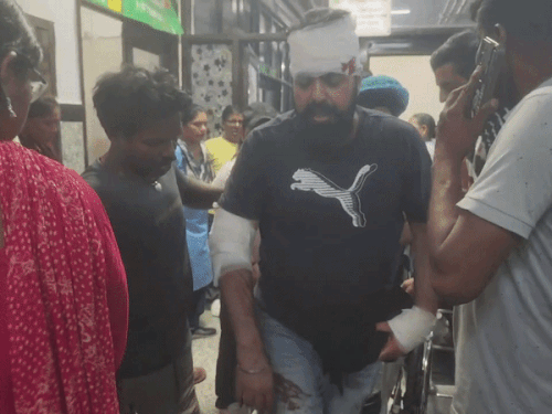 पंचकूला में NRI पर साले ने करवाई फायरिंग:गोली बाजू को छूकर निकली, चाकूओं से भी हमला; प्रॉपर्टी विवाद में वारदात