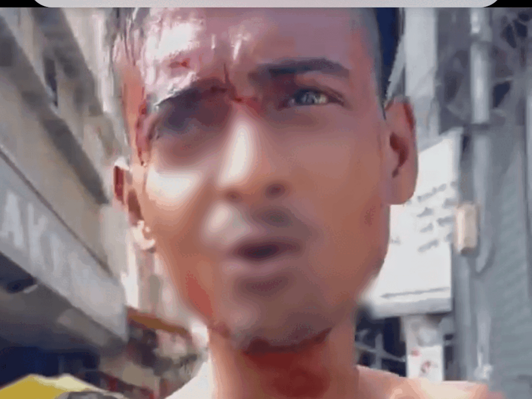 अबोहर में तस्करों की गुंडागर्दी, युवक को लहुलुहान कर घुमाया:नशा खरीदने को आरोपियों के पास 200 में गिरवी रखा था मोबाइल, 500 रुपए न देने पर बेहरमी से पीटा