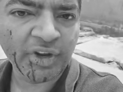 गुरुग्राम में रोडरेज, सड़क पर युवक की पिटाई-VIDEO:पीड़ित बोला- स्कॉर्पियो सवार जिग जैग ड्राइविंग कर रहे थे, साइड न देने पर मुंह तोड़ा