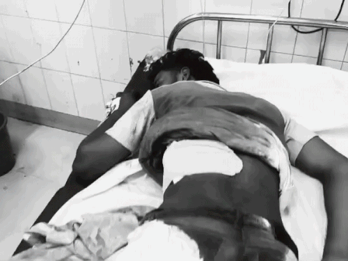 लुधियाना में बाइक सवार बदमाशों ने की लूट:काम से लौट रहे दो दोस्तों पर जानलेवा हमला, चाकू गोदकर लूटी चेन; हालत नाजुक, PGI रेफर