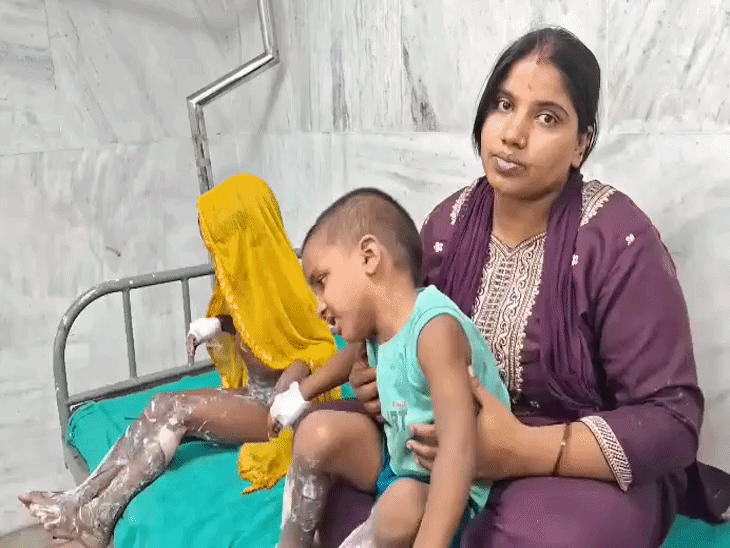 गुरदासपुर में घर में सिलेंडर ब्लास्ट से अफरातफरी:2 बच्चों सहित 6 लोग झुलसे; लोगों ने घायलों को अस्पताल में करवाया भर्ती