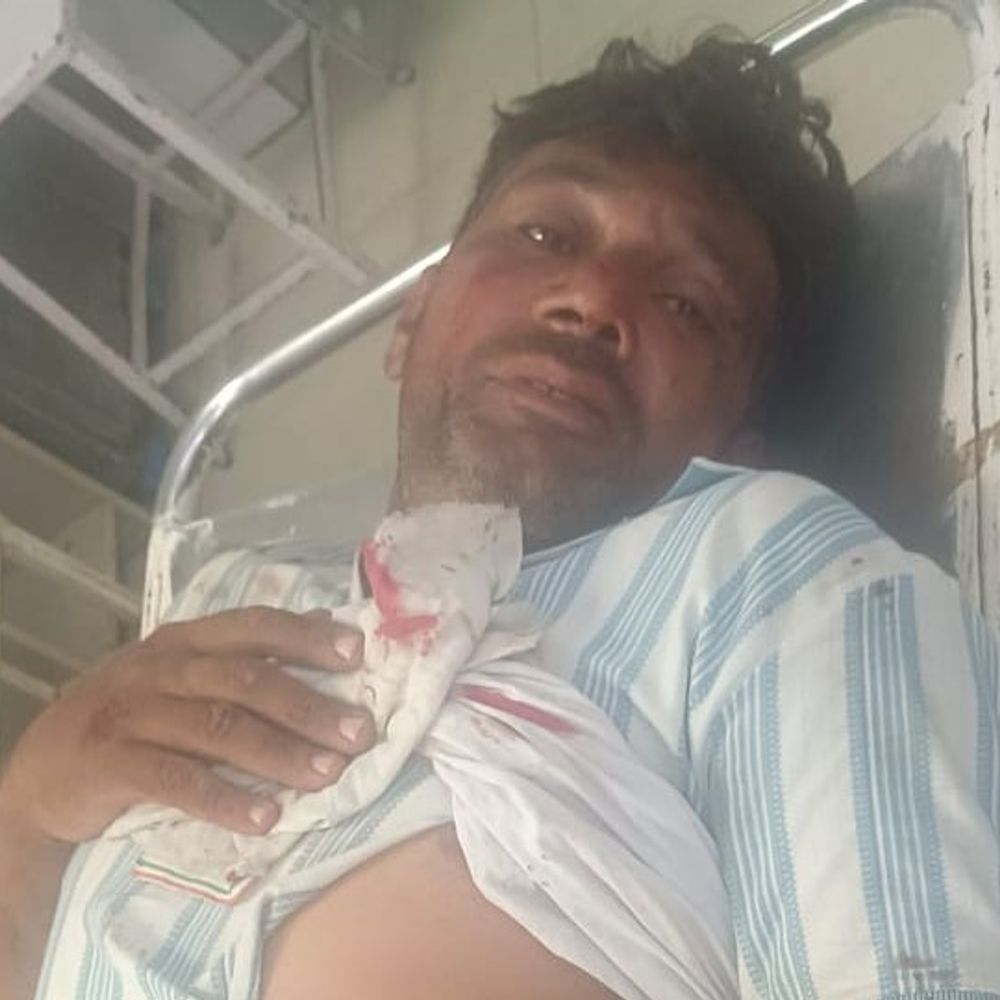 उकलाना में लाठी-डंडों से पिता- पुत्र पर हमला:ट्रैक्टर रोकने लेकर हुई झड़प, बाइक लगाकर रास्ता रोका, लाइसेंसी पिस्तौल से फायरिंग