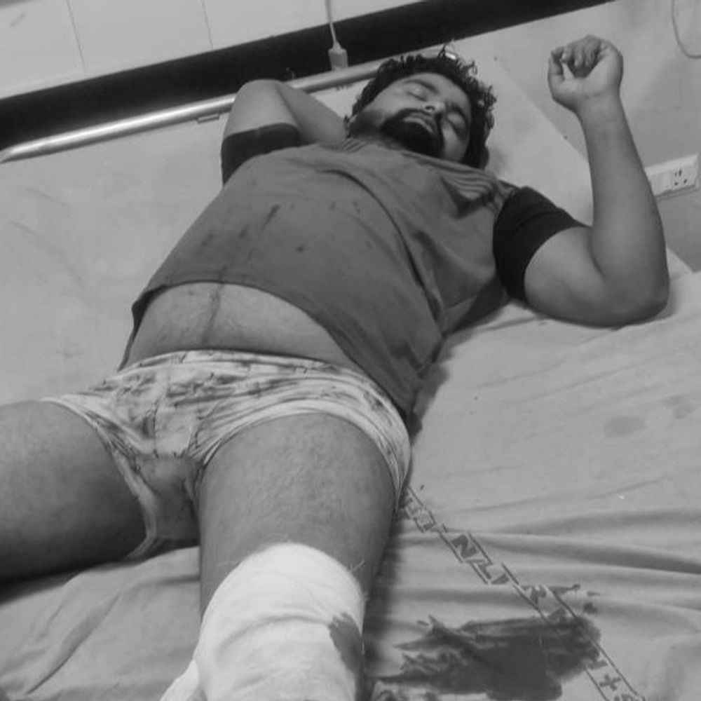नूंह में पुलिस- गोतस्कर में मुठभेड़:गोली लगने से एक घायल, पांच गोवंशों को कराया गया मुक्त, फरार आरोपियों की तलाश