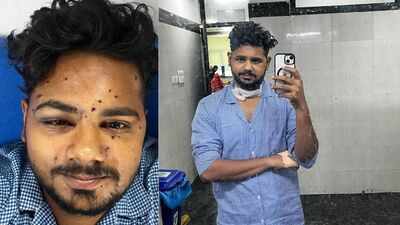 ‘Scars remain, but no regrets’, says protester injured by pellet gun | Delhi News