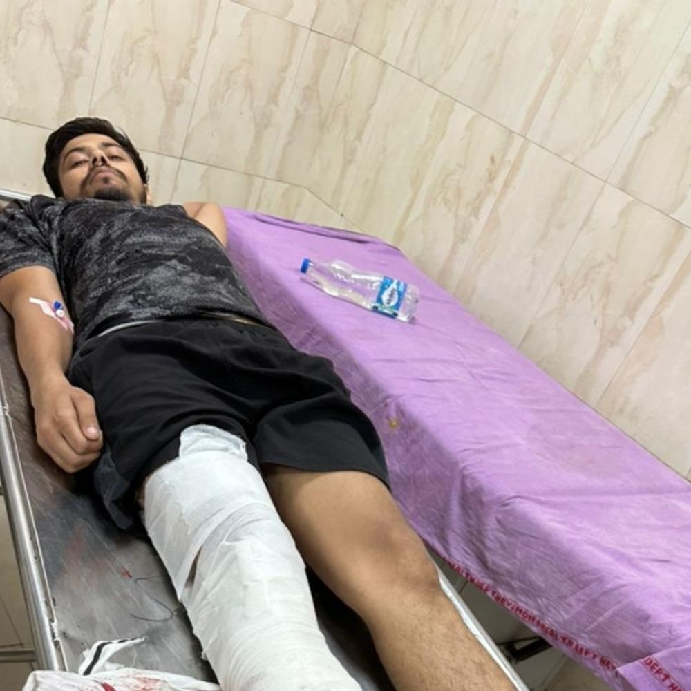 पुलिसकर्मी को दांत से काट कस्टडी से भागा बदमाश:कुरुक्षेत्र में बाथरूम करने के बहाने गाड़ी रुकवाई; पुलिस ने गोली मारकर पकड़ा