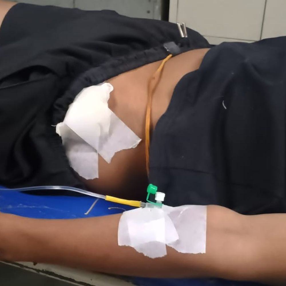Chandigarh Crime | Youth Stabbed in Ramdarbar, Hospitalized at GMCH-32